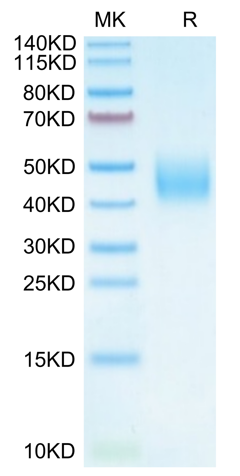 Cynomolgus B7-H6 on Tris-Bis PAGE under reduced condition. The purity is greater than 95%.