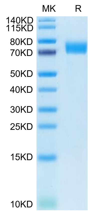 Human B7-H6 on Tris-Bis PAGE under reduced condition. The purity is greater than 95%.