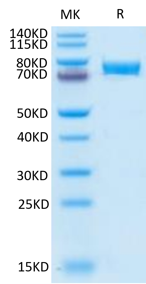 Human B7-H4 on Tris-Bis PAGE under reduced condition. The purity is greater than 95%.