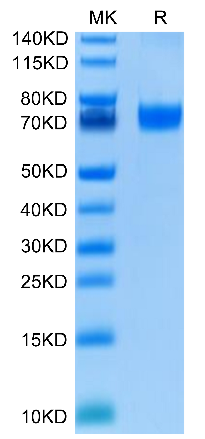 Human B7-H5 on Tris-Bis PAGE under reduced condition. The purity is greater than 95%.