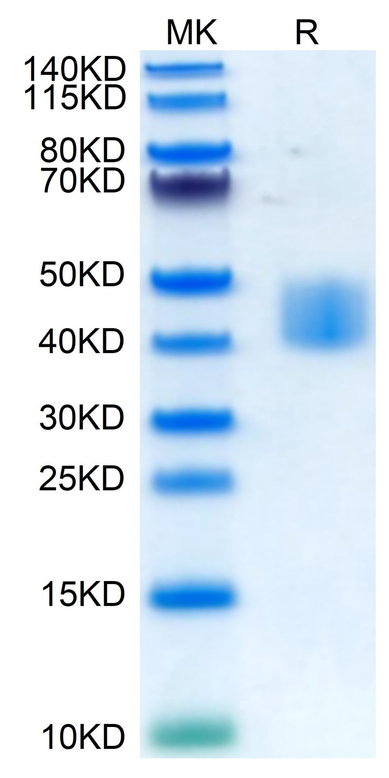 Human MSLN on Tris-Bis PAGE under reduced condition. The purity is greater than 95%.