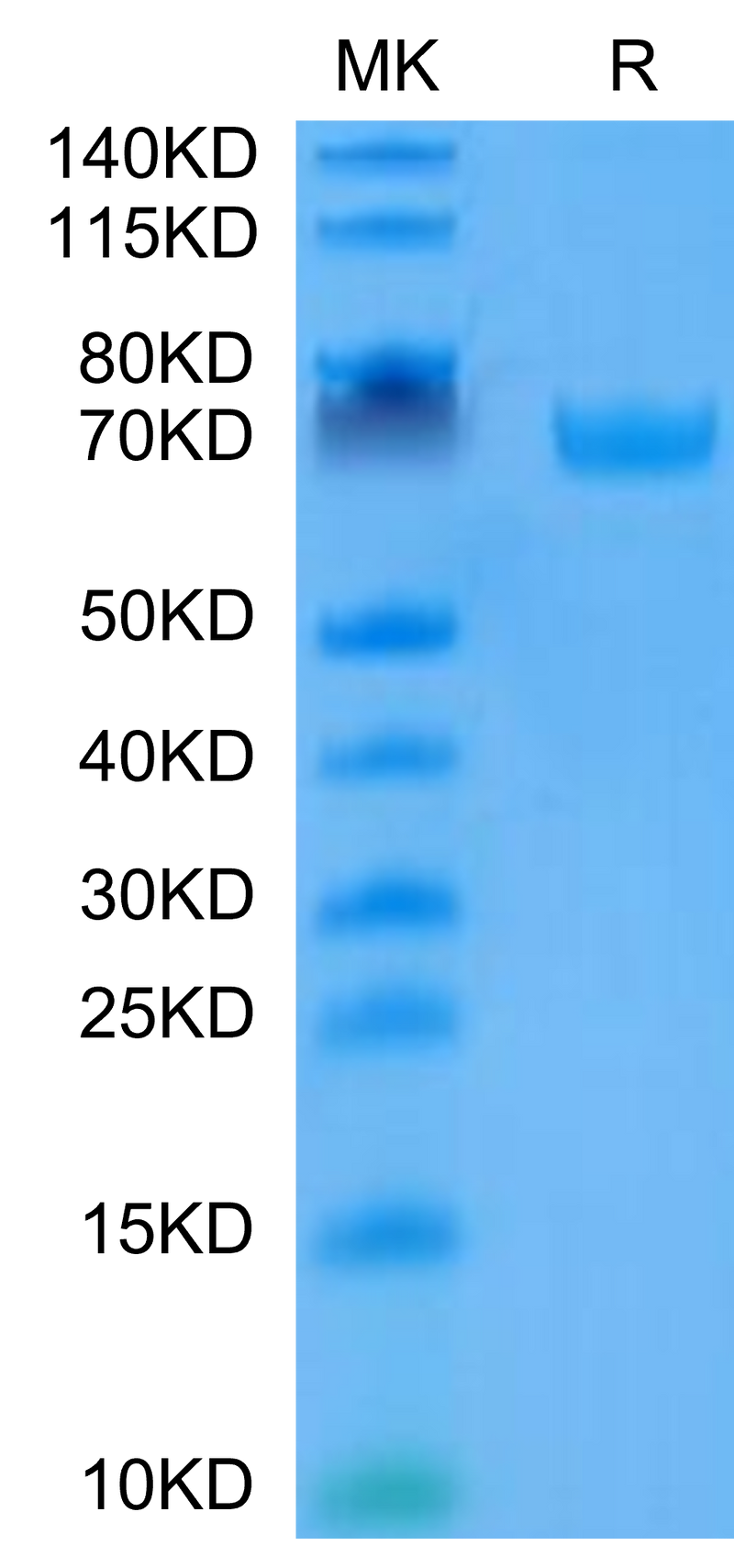 Human B7-H3 on Tris-Bis PAGE under reduced condition. The purity is greater than 95%.