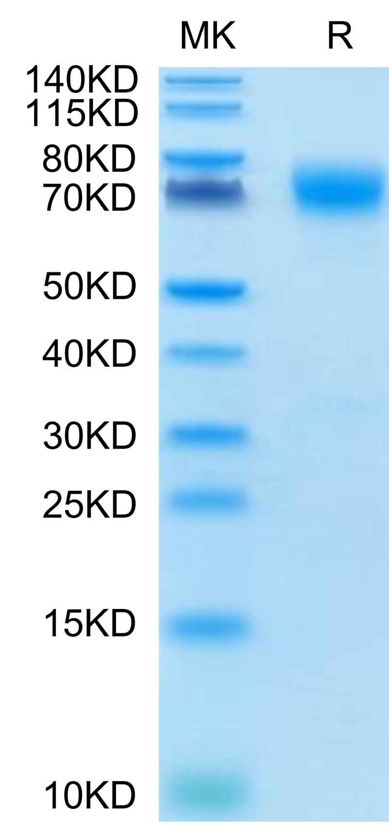 Cynomolgus B7-H3 on Tris-Bis PAGE under reduced condition. The purity is greater than 95%.