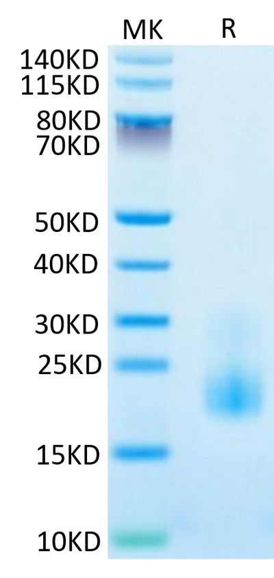 Cynomolgus/Rhesus macaque TIGIT on Tris-Bis PAGE under reduced condition. The purity is greater than 95%.