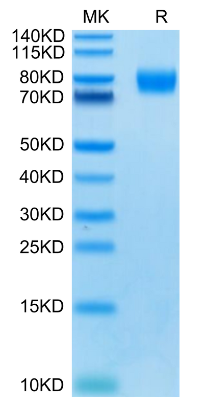 Human CD155 on Tris-Bis PAGE under reduced condition. The purity is greater than 95%.