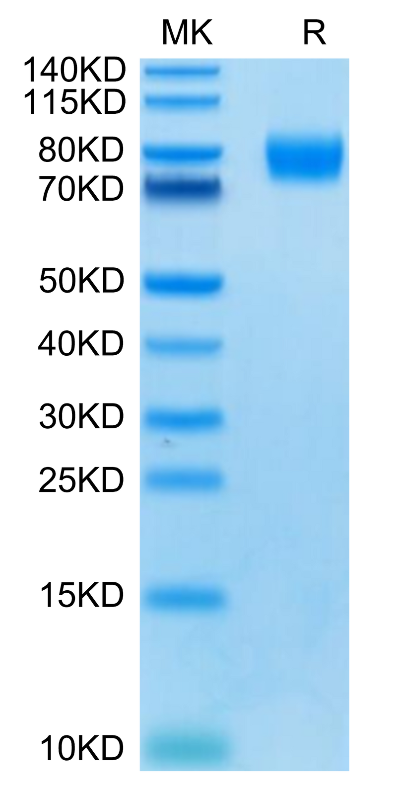 Human CD155 on Tris-Bis PAGE under reduced condition. The purity is greater than 95%.