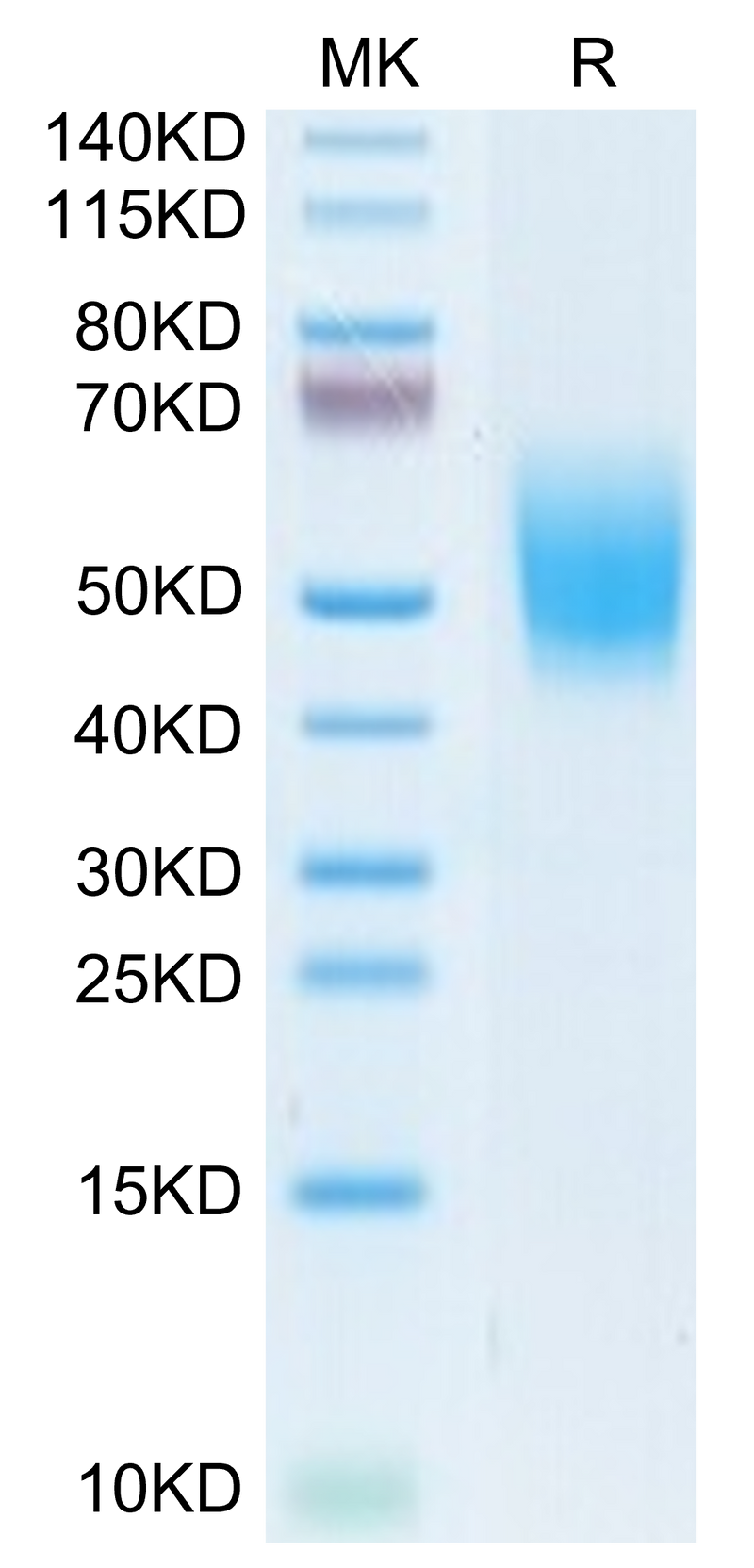 Cynomolgus DNAM-1 on Tris-Bis PAGE under reduced condition. The purity is greater than 95%.