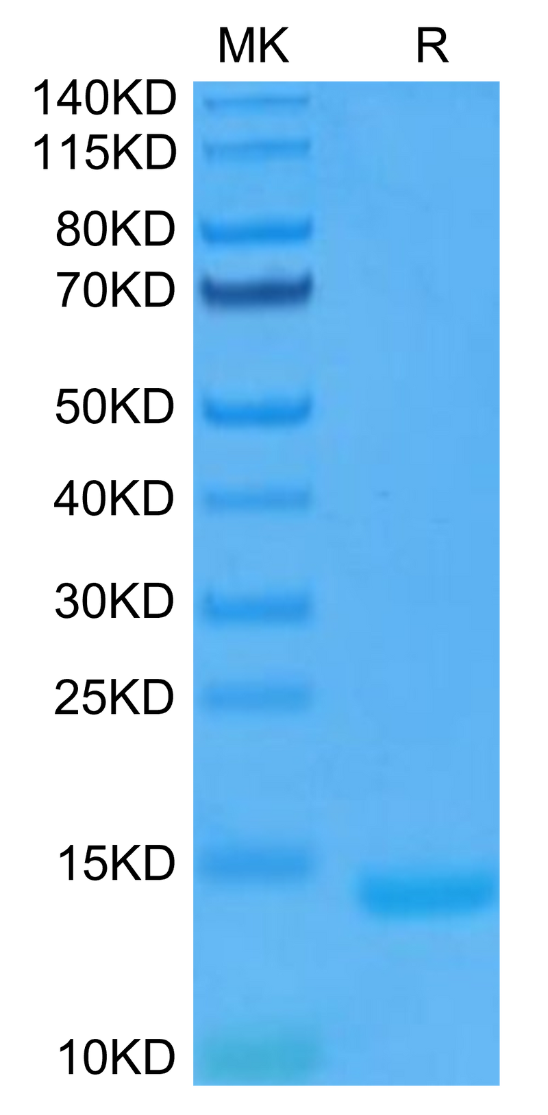 Human GM-CSF on Tris-Bis PAGE under reduced condition. The purity is greater than 95%.