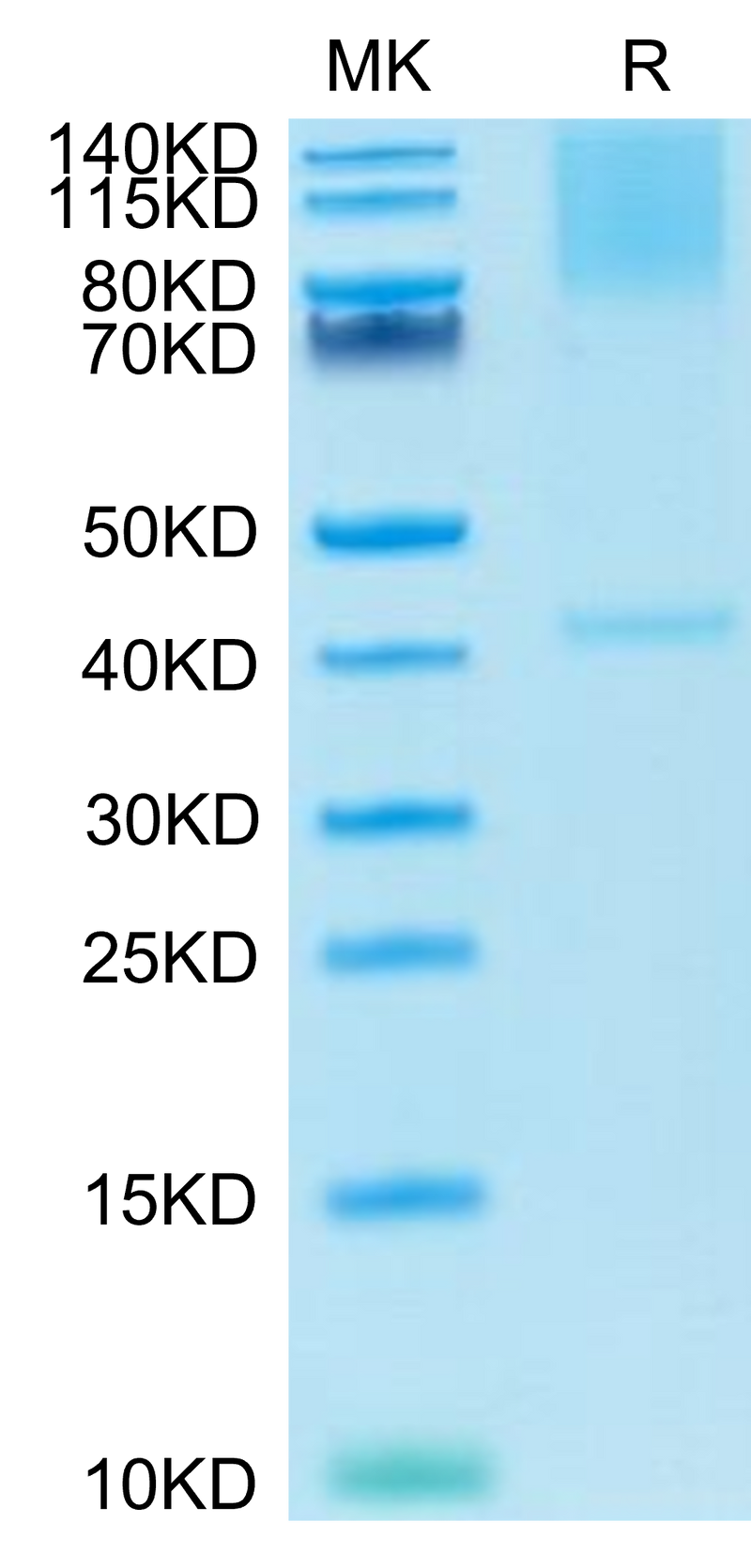 Cynomolgus GPC3 on Tris-Bis PAGE under reduced condition. The purity is greater than 95%.