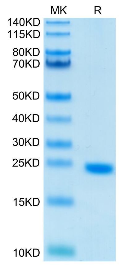 Human IL-6 on Tris-Bis PAGE under reduced condition. The purity is greater than 95%.