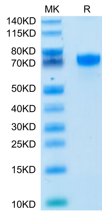 Human PD-L1 on Tris-Bis PAGE under reduced condition. The purity is greater than 95%.