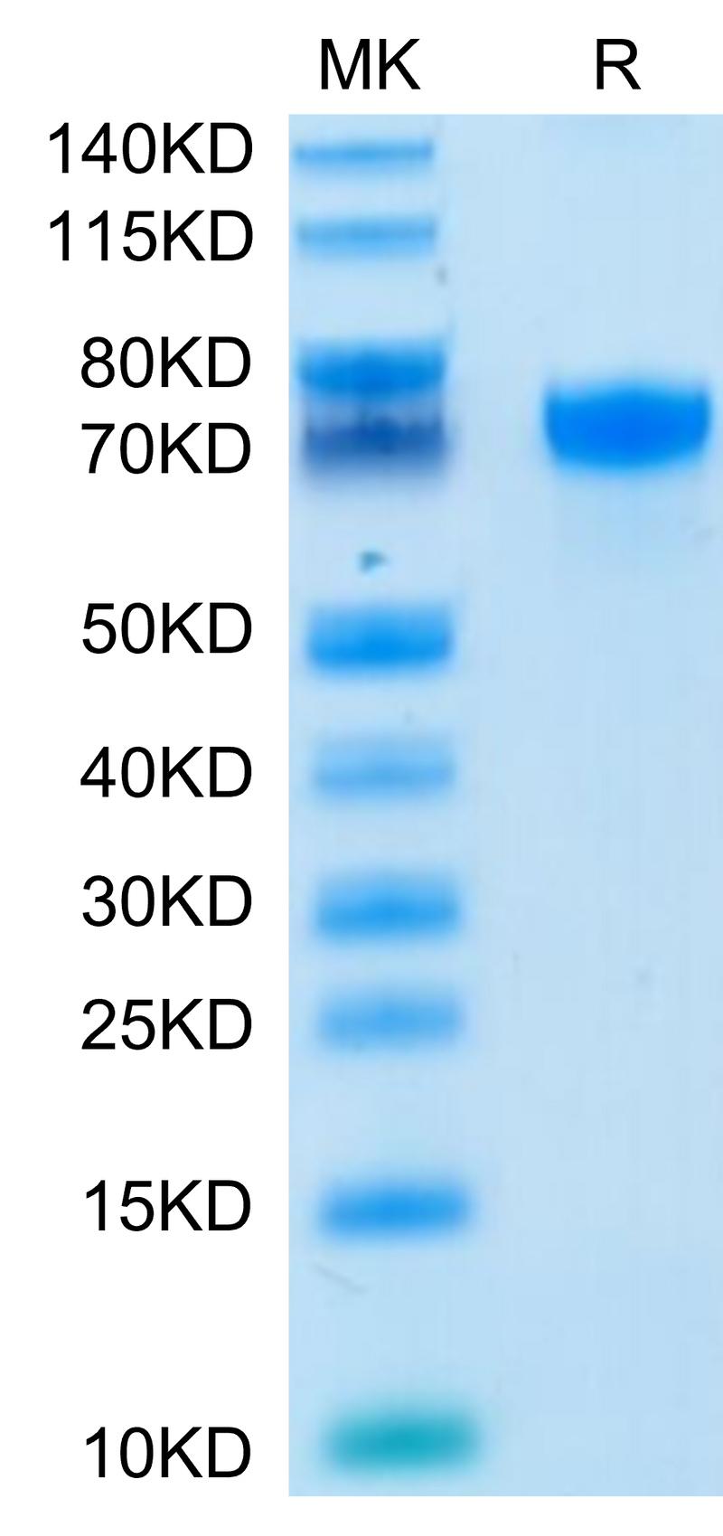 Human PD-L1 on Tris-Bis PAGE under reduced condition. The purity is greater than 95%.