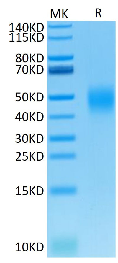 Mouse B7-H5 on Tris-Bis PAGE under reduced condition. The purity is greater than 95%.