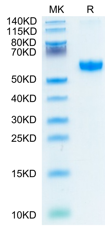 Human 4-1BB on Tris-Bis PAGE under reduced condition. The purity is greater than 95%.