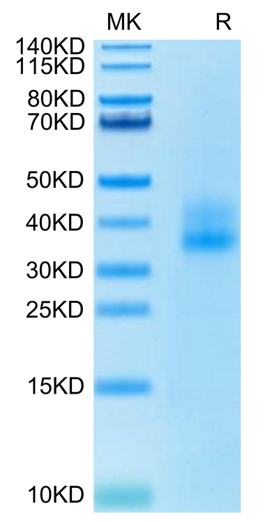 Human 4-1BB on Tris-Bis PAGE under reduced condition. The purity is greater than 95%.