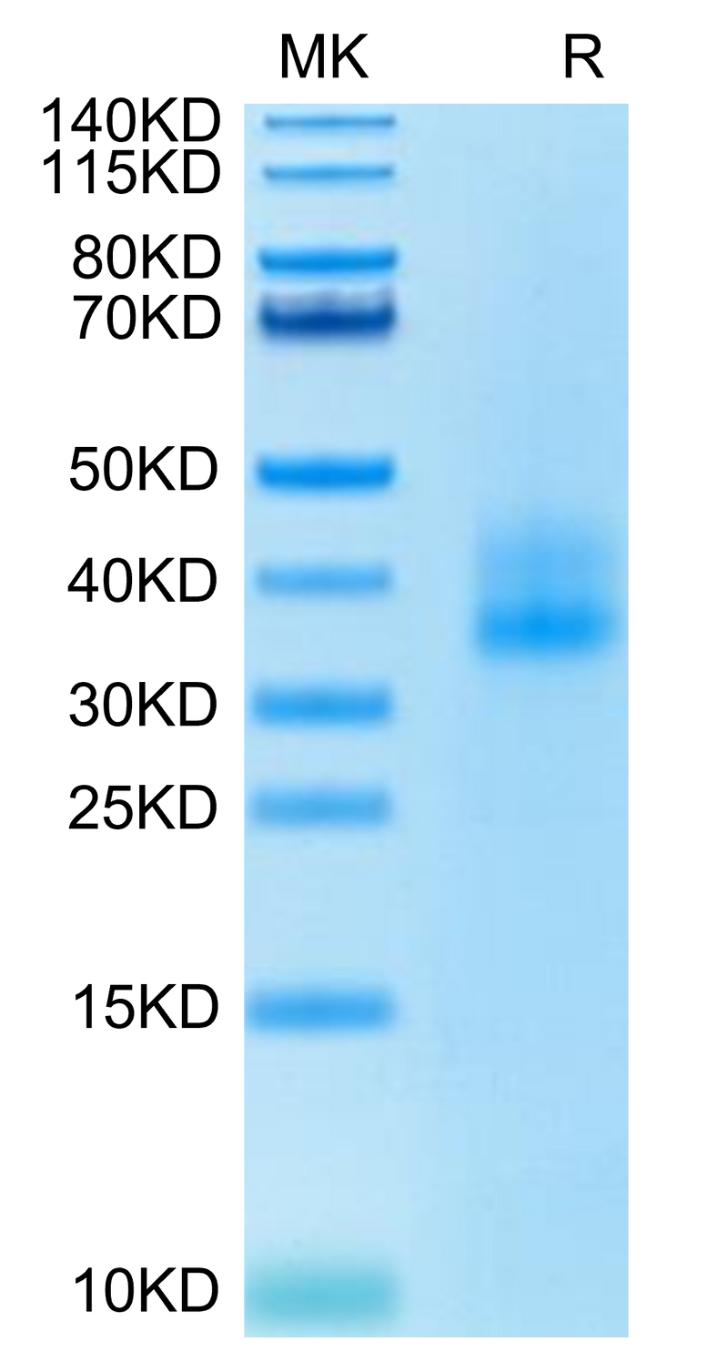 Human 4-1BB on Tris-Bis PAGE under reduced condition. The purity is greater than 95%.