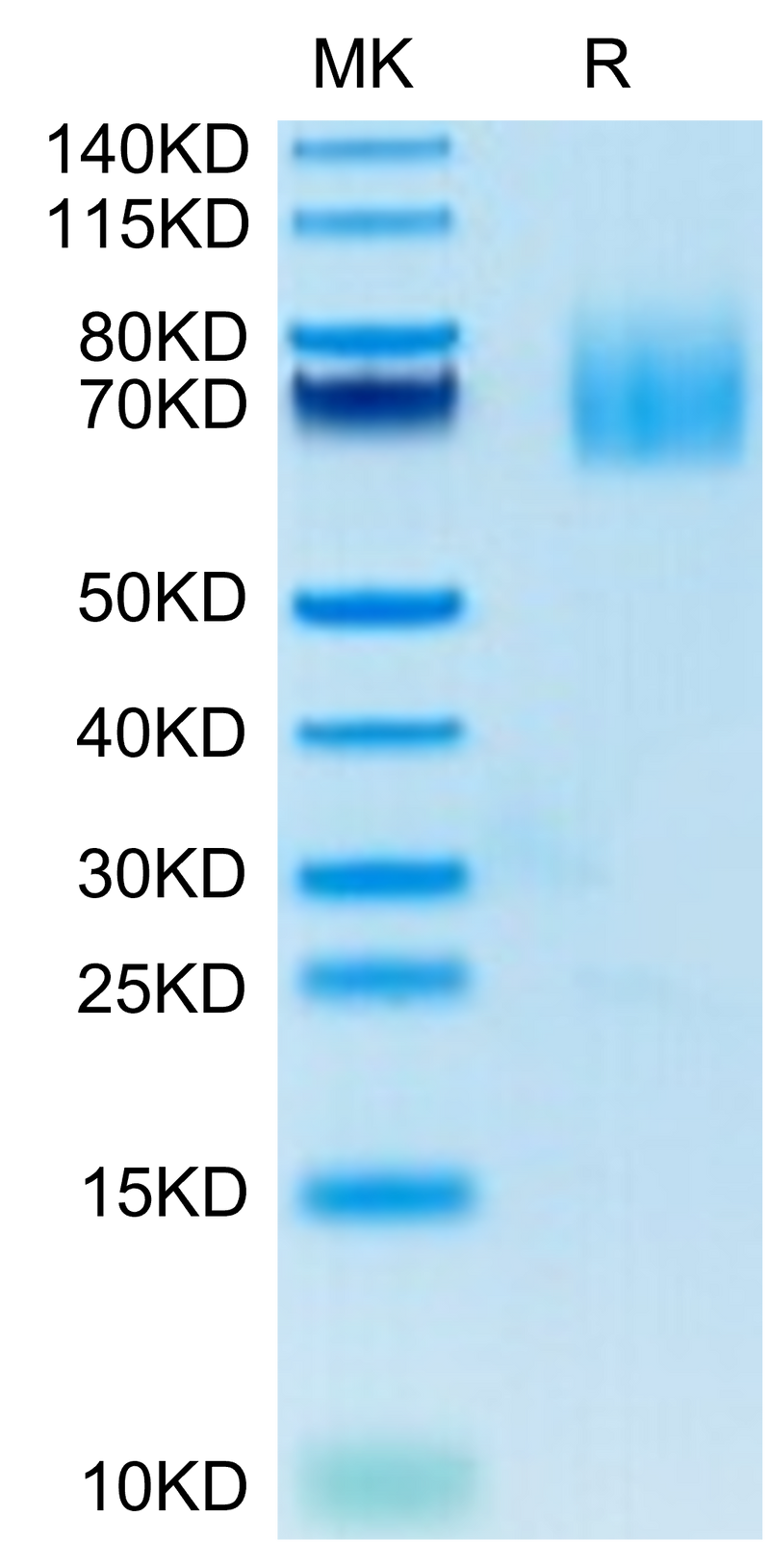 Human CD27 Ligand on Tris-Bis PAGE under reduced condition. The purity is greater than 95%.