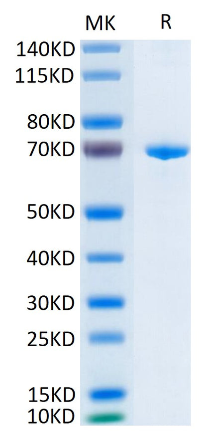 Human Her3 on Tris-Bis PAGE under reduced condition. The purity is greater than 95%.