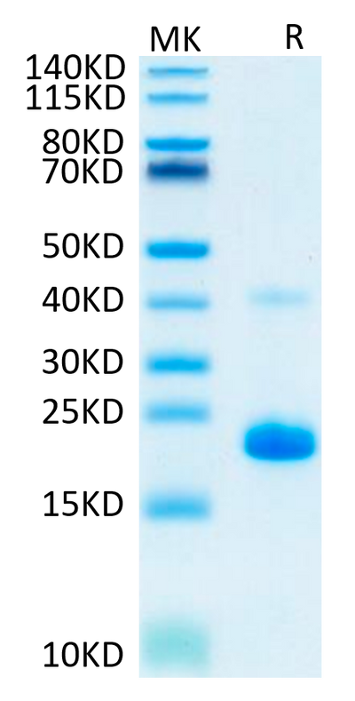 Human TNF alpha on Tris-Bis PAGE under reduced condition. The purity is greater than 95%.