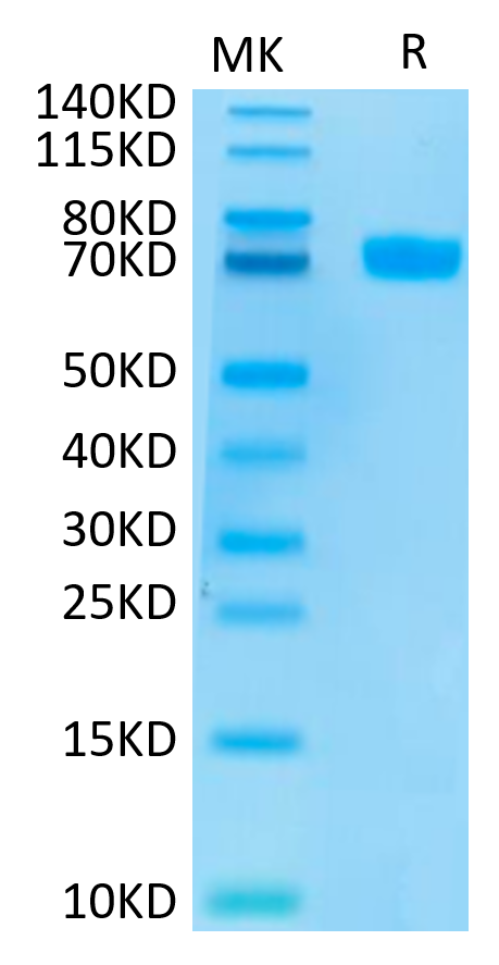 Human MSLN on Tris-Bis PAGE under reduced conditions. The purity is greater than 95%.