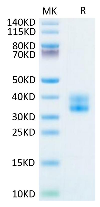 Biotinylated Human 4-1BB on Tris-Bis PAGE under reduced condition. The purity is greater than 95%.