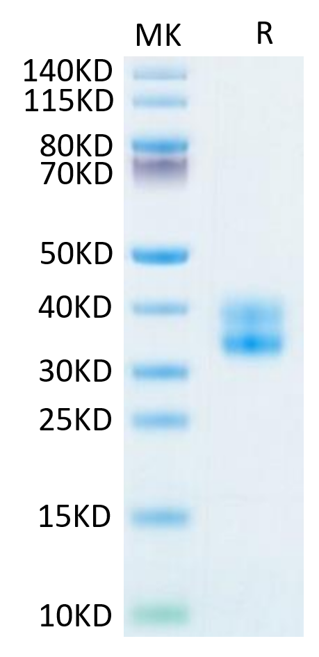 Biotinylated Human 4-1BB on Tris-Bis PAGE under reduced condition. The purity is greater than 95%.