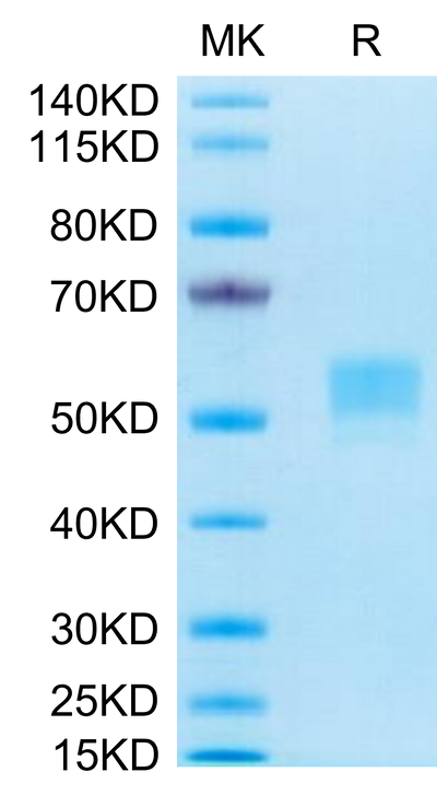 Human CD79B on Tris-Bis PAGE under reduced conditions. The purity is greater than 95%.