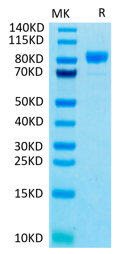 Human FGFR4 on Tris-Bis PAGE under reduced conditions. The purity is greater than 95%.