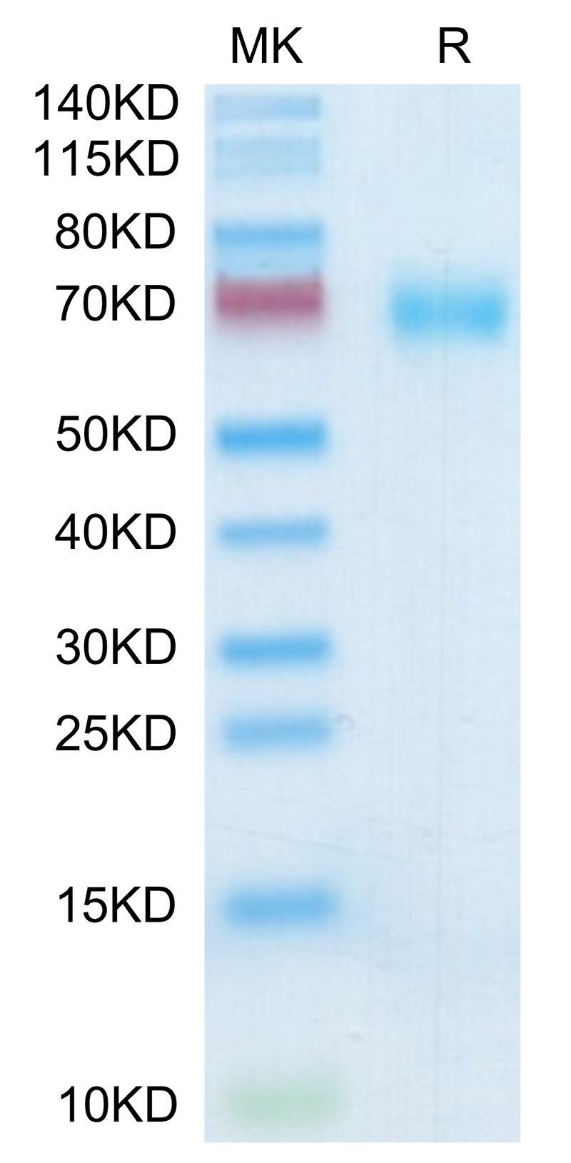 Human SLAMF7 on Tris-Bis PAGE under reduced condition. The purity is greater than 95%.