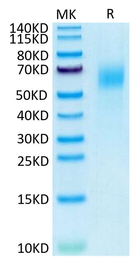 Human IL-13Ra1 on Tris-Bis PAGE under reduced condition. The purity is greater than 95%.