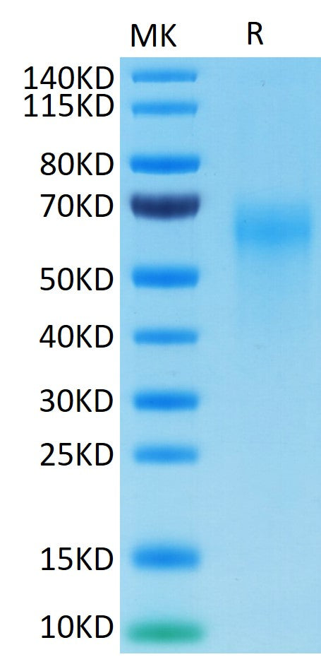 Cynomolgus IL-2 R gamma on Tris-Bis PAGE under reduced conditions. The purity is greater than 95%.