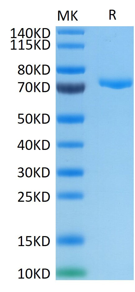 Human Nectin-4 on Tris-Bis PAGE under reduced conditions. The purity is greater than 95%.