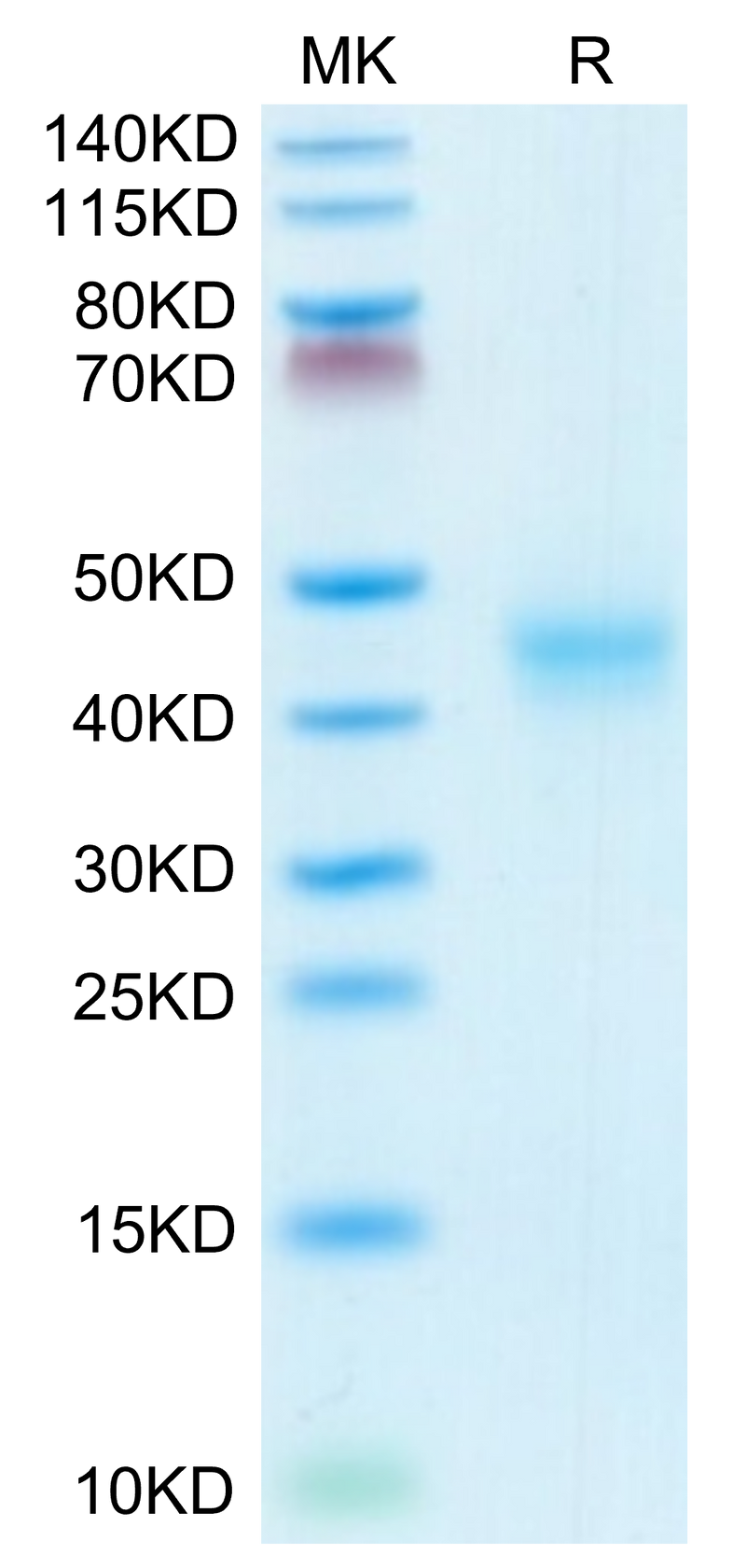 Mouse CD52 on Tris-Bis PAGE under reduced conditions. The purity is greater than 95%.