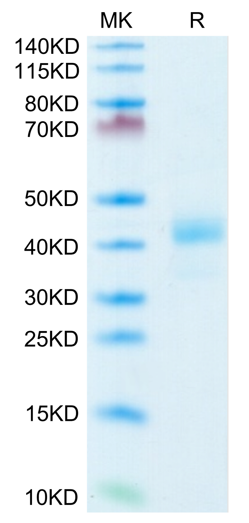 Human CD52 on Tris-Bis PAGE under reduced condition. The purity is greater than 95%.