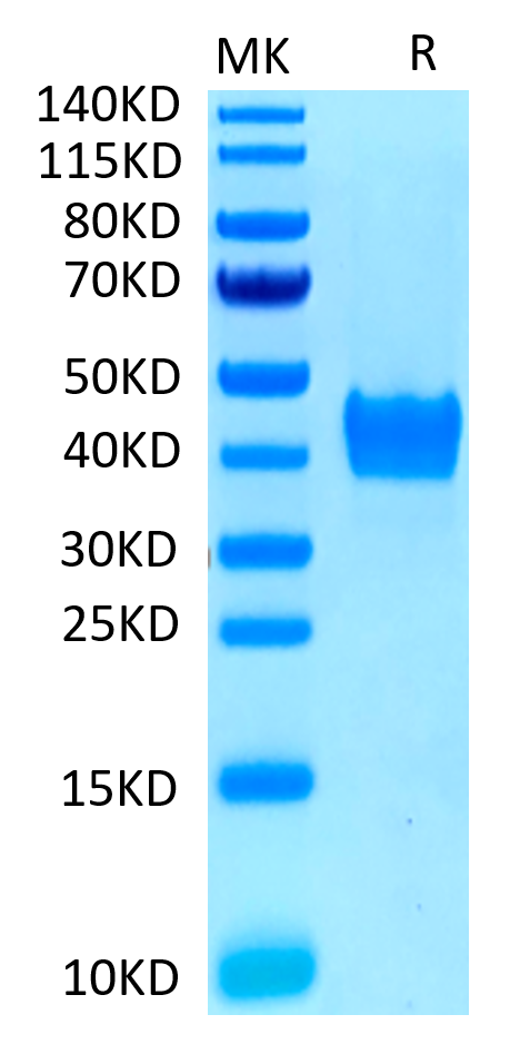 Human CD52 on Tris-Bis PAGE under reduced conditions. The purity is greater than 95%.