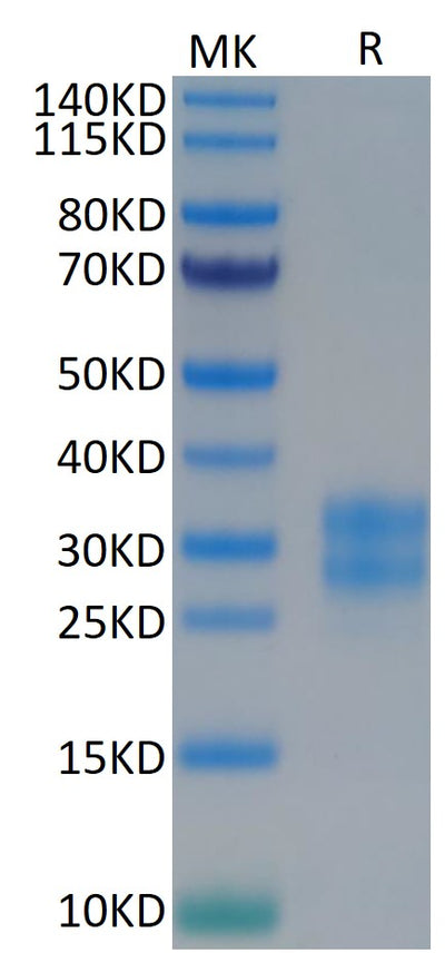 Human M-CSF on Tris-Bis PAGE under reduced conditions. The purity is greater than 95%.