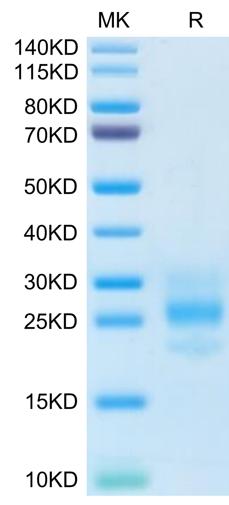 Human M-CSF on Tris-Bis PAGE under reduced condition. The purity is greater than 95%.