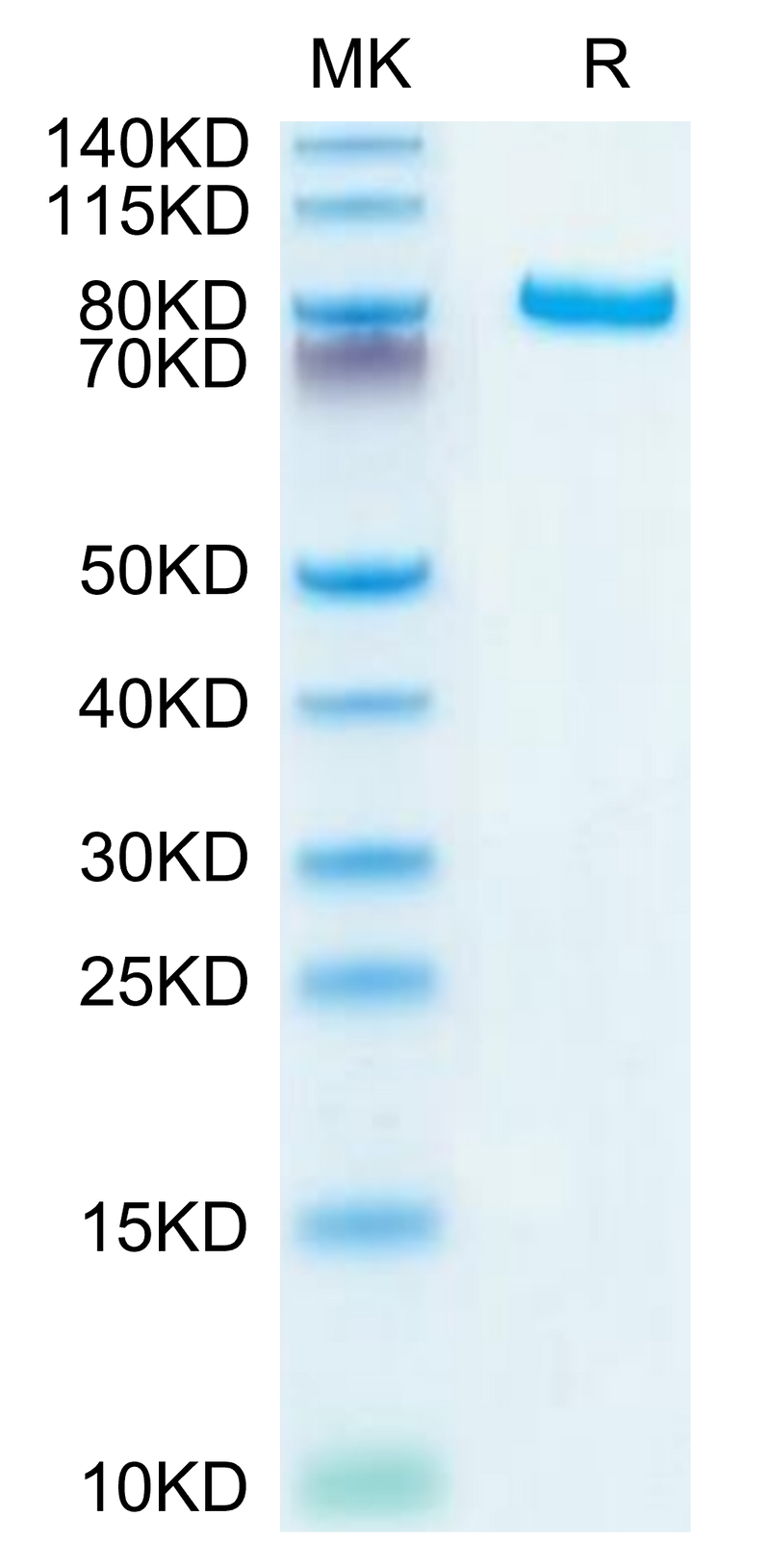 Human DLL4 on Tris-Bis PAGE under reduced conditions. The purity is greater than 95%.