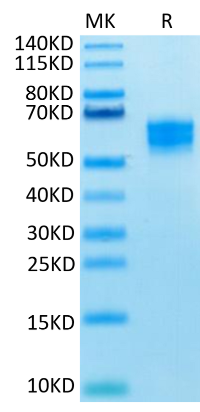 Human NKG2D on Tris-Bis PAGE under reduced condition. The purity is greater than 95%.