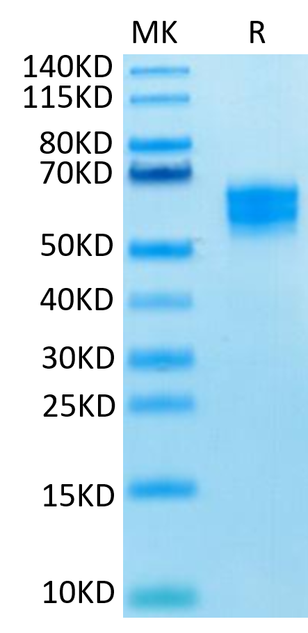 Human NKG2D on Tris-Bis PAGE under reduced condition. The purity is greater than 95%.