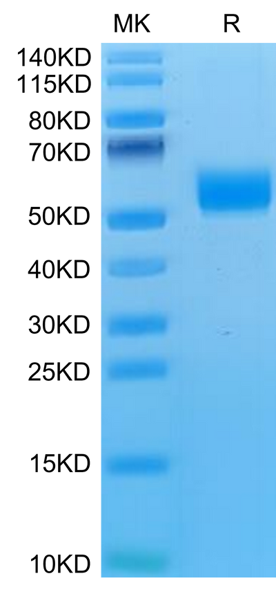 Mouse NKG2D on Tris-Bis PAGE under reduced condition. The purity is greater than 95%.