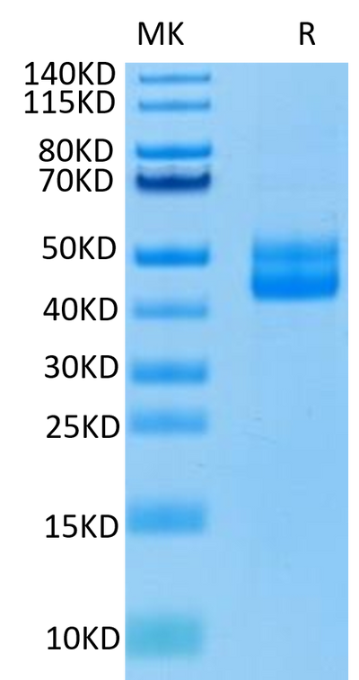 Human CD3E on Tris-Bis PAGE under reduced condition. The purity is greater than 95%.