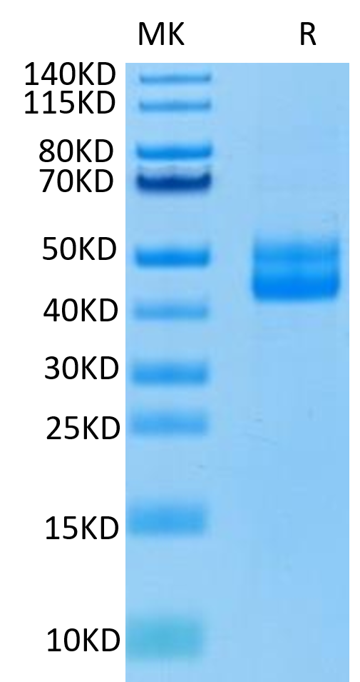 Human CD3E on Tris-Bis PAGE under reduced condition. The purity is greater than 95%.