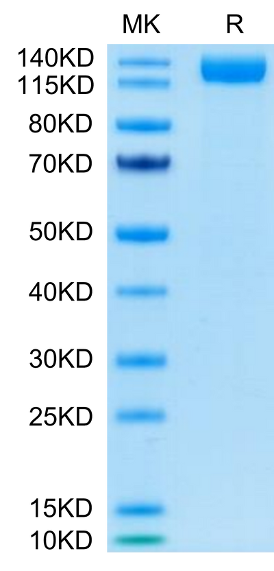 SARS-COV-2 Spike S1 on Tris-Bis PAGE under reduced condition. The purity is greater than 95%.