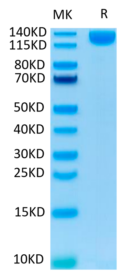 SARS-COV-2 Spike S1 on Tris-Bis PAGE under reduced condition. The purity is greater than 95%.