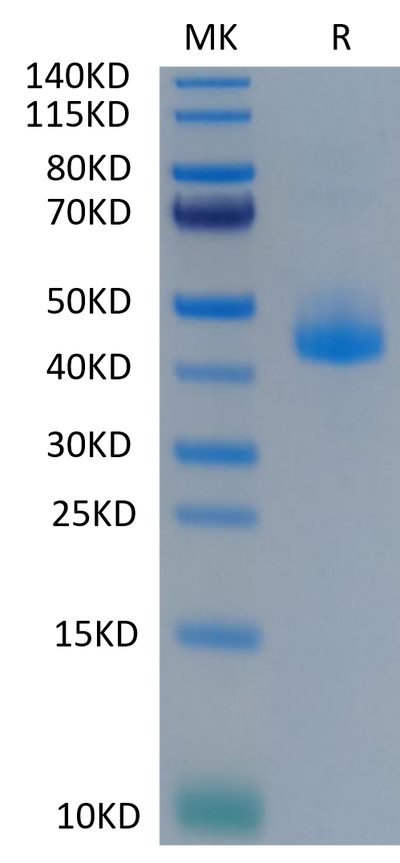 Cynomolgus CD3E on Tris-Bis PAGE under reduced condition. The purity is greater than 95%.