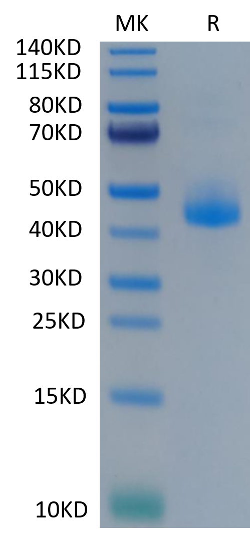 Cynomolgus CD3E on Tris-Bis PAGE under reduced condition. The purity is greater than 95%.