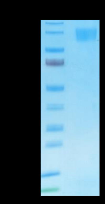 SARS Spike S1 on Tris-Bis PAGE under reduced condition. The purity is greater than 95%.