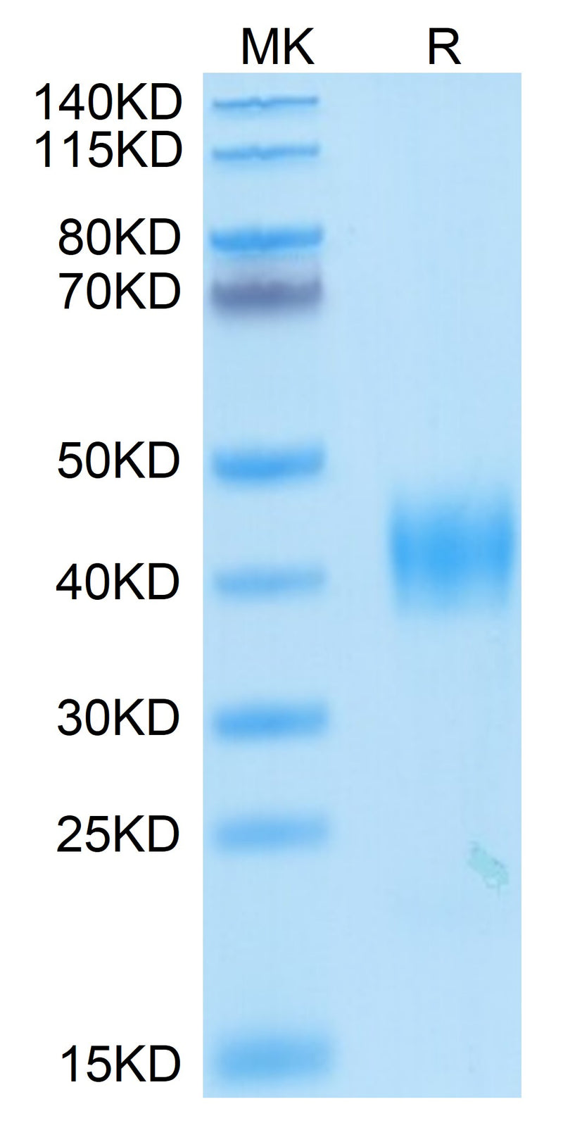 SARS Spike RBD on Tris-Bis PAGE under reduced condition. The purity is greater than 95%.