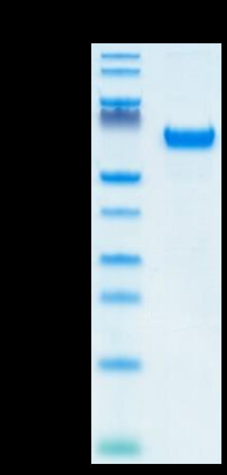 Human FOLR1 on Tris-Bis PAGE under reduced condition. The purity is greater than 95%.